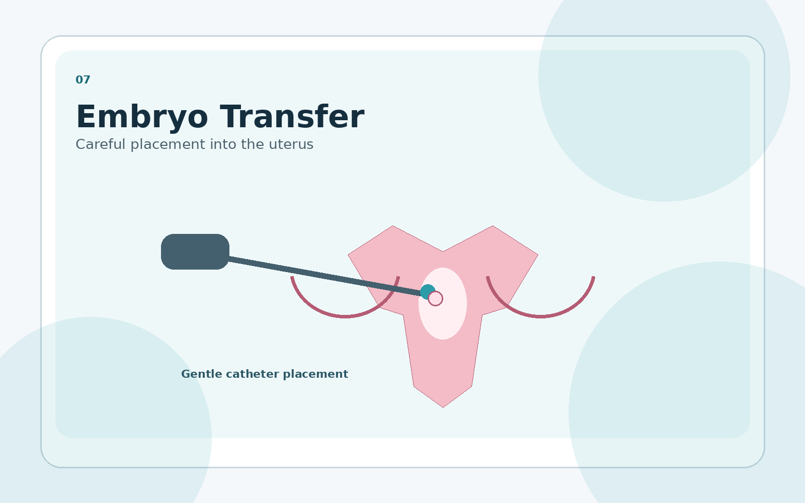 Embryo transfer