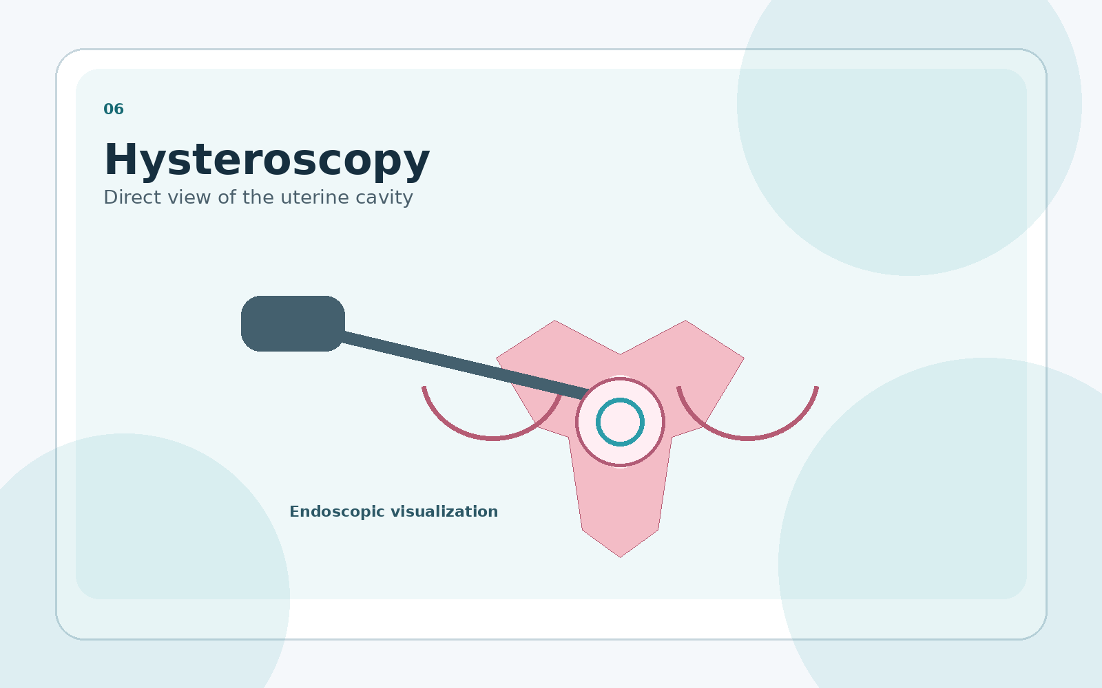 Hysteroscopy procedure