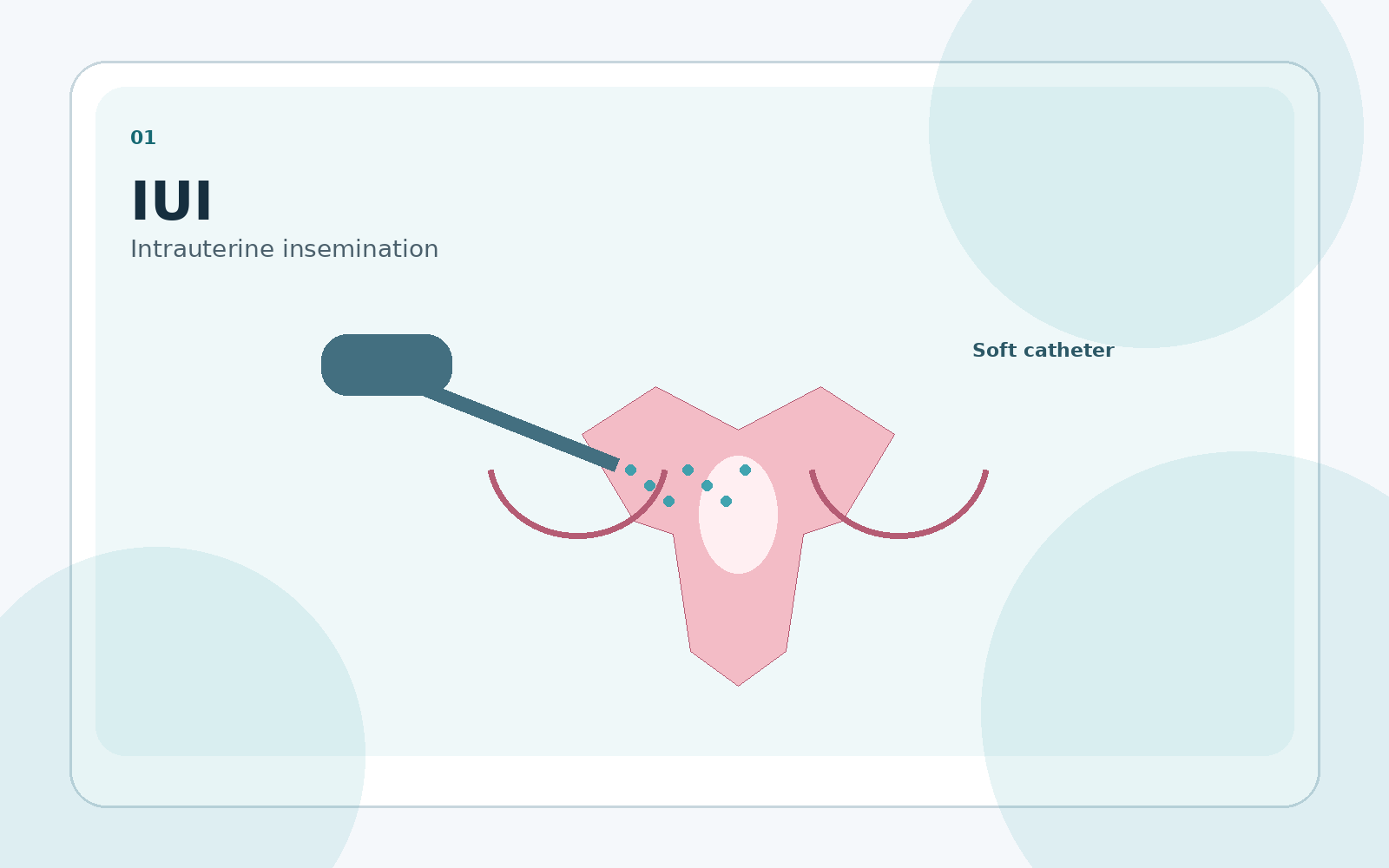 IUI treatment