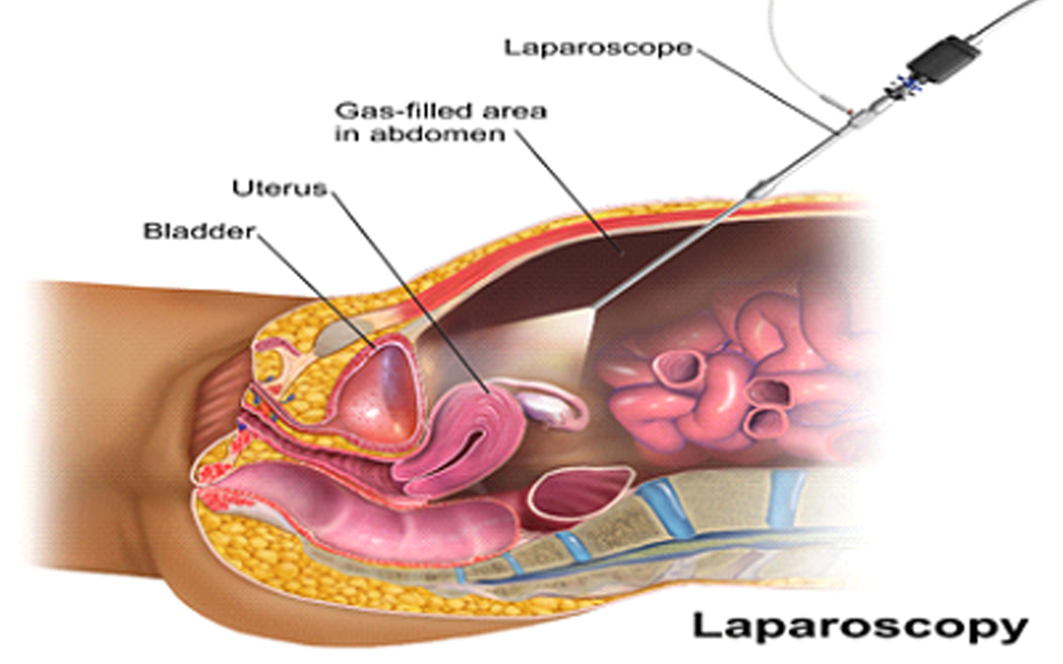 lab-rcpost